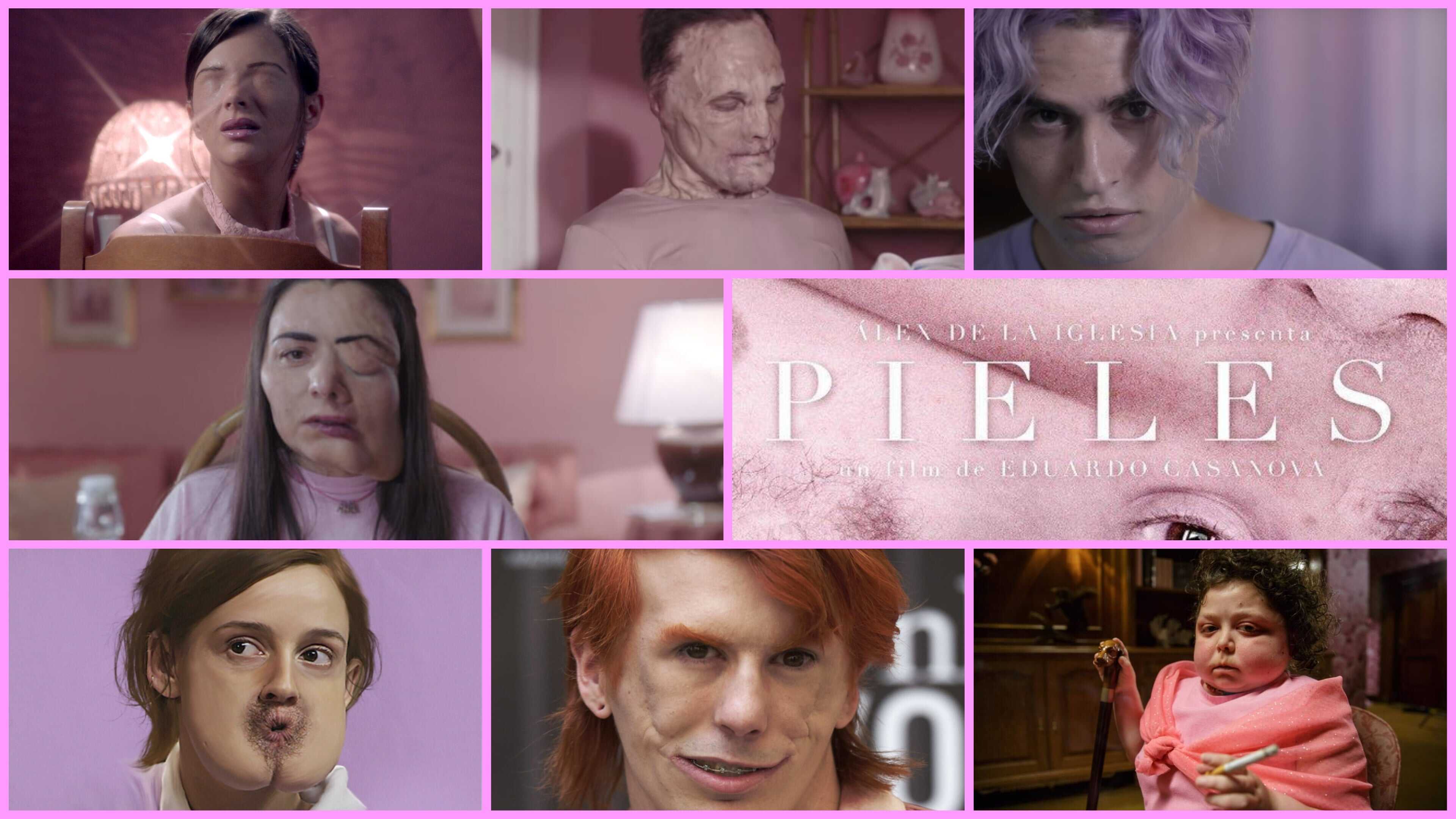 Pieles 1