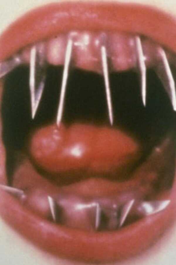 Le Dentiste 2 (1998) 0